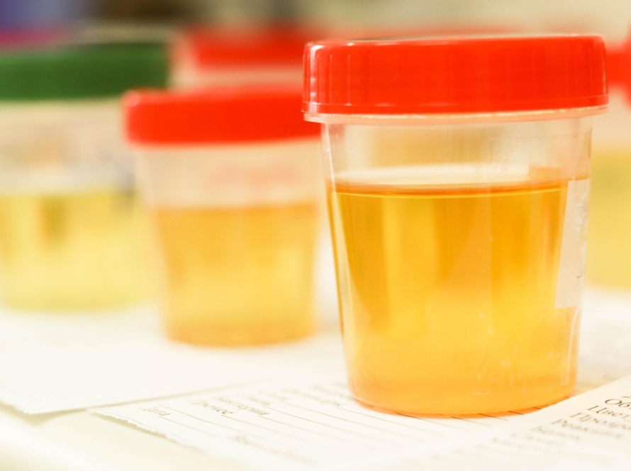 urine drug test in meadows place texas