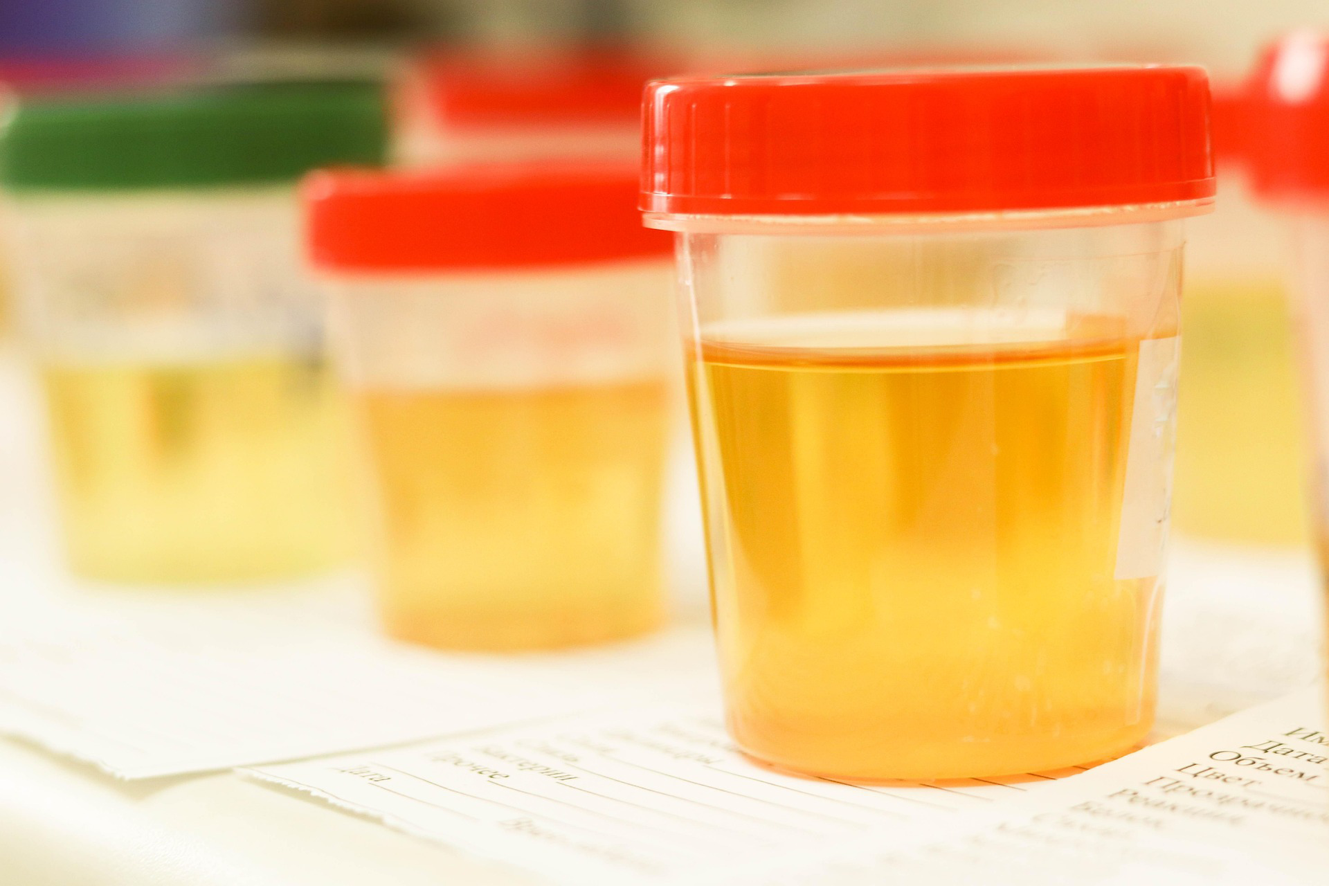 Urine Drug Testing